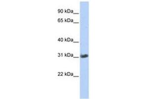 Image no. 1 for anti-Zinc Finger, AN1-Type Domain 3 (ZFAND3) (C-Term) antibody (ABIN6740610)