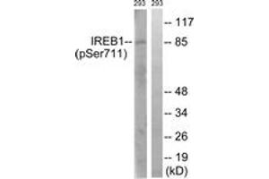 Western blot analysis of extracts from 293 cells treated with insulin 0. (Aconitase 1 抗体  (pSer711))