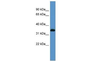 Western Blotting (WB) image for anti-ATPase, Na+/K+ Transporting, beta 2 Polypeptide (ATP1B2) (N-Term) antibody (ABIN2782135)