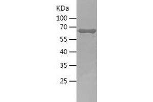 Western Blotting (WB) image for Growth Associated Protein 43 (GAP43) (AA 1-238) protein (His-IF2DI Tag) (ABIN7123204) (GAP43 Protein (AA 1-238) (His-IF2DI Tag))