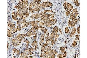 IHC analysis of AIF using anti-AIF antibody (ABIN6719266).