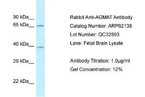 Western Blotting (WB) image for anti-Agmatine Ureohydrolase (Agmatinase) (AGMAT) (N-Term) antibody (ABIN2789033) (AGMAT 抗体  (N-Term))