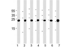 Cebpd antibody western blot analysis in 1) A549, 2) HeLa, 3) NCI-H460, 4) U-937, 5) mouse NIH3T3 cell line, rat 6) lung and 7) testis tissue lysate. (CEBPD 抗体  (AA 161-189))