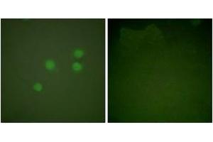 Immunofluorescence analysis of A549 cells, using Cyclin E1 Antibody. (Cyclin E1 抗体  (AA 91-140))