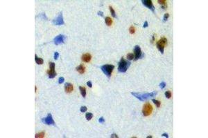 Immunohistochemical analysis of JMJD6 staining in mouse brain formalin fixed paraffin embedded tissue section. (JMJD6 抗体)