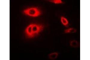 Immunofluorescent analysis of RIPK2 staining in MCF7 cells. (RIPK2 抗体)