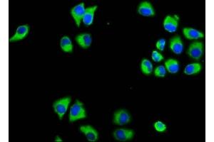 Immunofluorescence staining of Hela cells with ABIN7159009 at 1:133, counter-stained with DAPI. (MARVELD3 抗体  (AA 1-189))