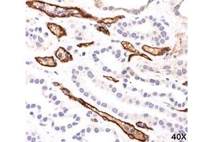 IHC testing of FFPE human kidney transplant tissue (40X) stained with Complement 4d / C4d antibody (C4D204). (Complement C4d 抗体)
