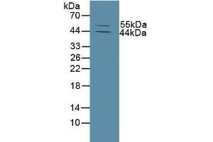 Detection of MMP13 in Mouse Skin Tissue using Polyclonal Antibody to Matrix Metalloproteinase 13 (MMP13)