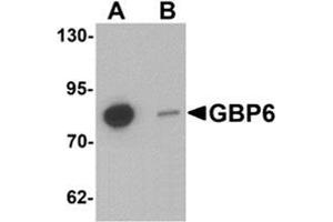 Western blot analysis of GBP6 in Hela cell lysate with GBP6 Antibody  at 0. (GBP6 抗体  (C-Term))