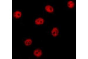 ABIN6274375 staining HT29 cells by IF/ICC. (NAB2 抗体  (C-Term))