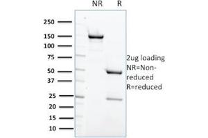 SDS-PAGE Analysis Purified PTPN6 Mouse Monoclonal Antibody (CPTC-PTPN6-2). (SHP1 抗体)