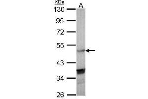 WB Image Sample (30 ug of whole cell lysate) A: Molt-4 , 10% SDS PAGE antibody diluted at 1:1000 (NR1H3 抗体  (C-Term))