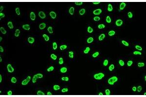 Immunofluorescence analysis of HeLa cells using SNRPA Polyclonal Antibody (SNRPA1 抗体)