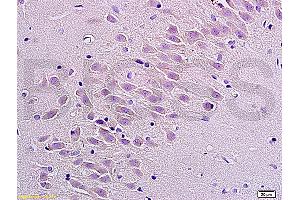 Immunohistochemistry (IHC) image for anti-Tachykinin Receptor 1 (TACR1) (AA 2-50) antibody (ABIN724385)
