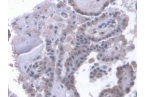IHC-P analysis of Human Thyroid Tissue, with DAB staining.