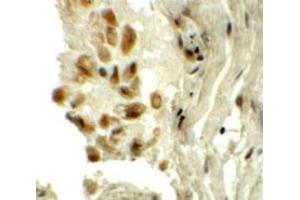 Immunohistochemical staining of human lung cells with TYW1 polyclonal antibody  at 5 ug/mL. (TYW1 抗体  (C-Term))