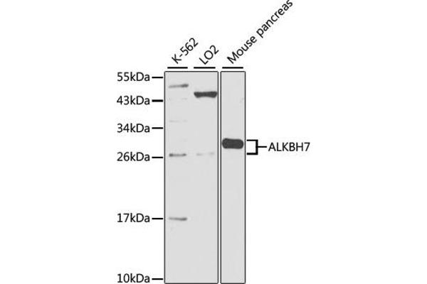ALKBH7 anticorps  (AA 1-221)