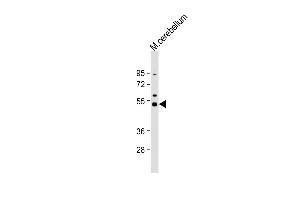 Anti-Dnmt2 Antibody  at 1:1000 dilution + mouse cerebellum lysate Lysates/proteins at 20 μg per lane. (Dnmt2 抗体  (AA 346-375))