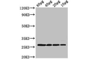 Western Blot Positive WB detected in: Rosseta bacteria lysate at 80 μg, 40 μg, 20 μg, 10 μg All lanes: rpsB antibody at 2. (rPSB (AA 2-241) 抗体)