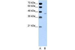 Pannexin 1 antibody used at 1 ug/ml to detect target protein. (PANX1 抗体  (Middle Region))