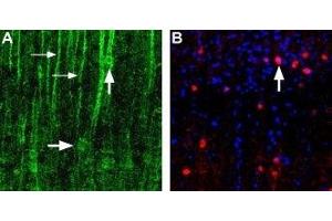 Expression of α1D-Adrenoceptor in rat neocortex - Immunohistochemical staining of α1D-adrenoceptor in rat neocortex using Anti-α1D-Adrenergic Receptor (extracellular) Antibody (ABIN7042896, ABIN7043916 and ABIN7043917). (ADRA1D 抗体  (C240S, Extracellular))