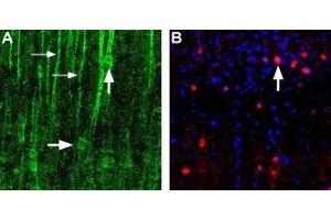 Expression of α1D-Adrenoceptor in rat neocortex - Immunohistochemical staining of α1D-adrenoceptor in rat neocortex using Anti-α1D-Adrenergic Receptor (extracellular) Antibody (ABIN7042896, ABIN7043916 and ABIN7043917). (ADRA1D 抗体  (3rd Extracellular Loop, Cys240))