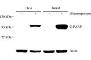 Western blot analysis of PARP1 (ABIN7075114),at dilution of 1: 1000 (PARP1 抗体  (cleaved))