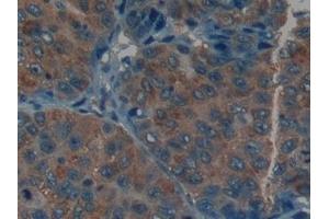 Immunohistochemistry (IHC) image for anti-Keratin 9 (KRT9) (AA 315-456) antibody (ABIN7431980)