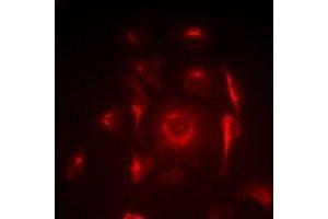 Immunofluorescent analysis of ACAS2 staining in SW620 cells. (ACSS2 抗体)