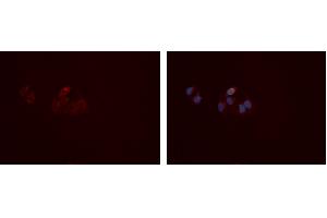ABIN6277407 staining Hela cells by IF/ICC. (MMP10 抗体  (Internal Region))