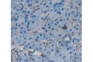 Immunohistochemistry (IHC) image for anti-Sema Domain, Immunoglobulin Domain (Ig), Transmembrane Domain (TM) and Short Cytoplasmic Domain, (Semaphorin) 4B (SEMA4B) (AA 192-367) antibody (ABIN1171799)