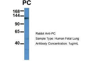 Host: Rabbit  Target Name: PC  Sample Tissue: Human Fetal Lung  Antibody Dilution: 1. (PC (C-Term) 抗体)