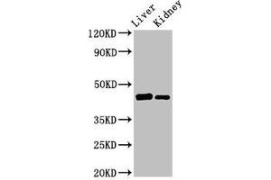 Western Blot Positive WB detected in: Rat liver tissue, Mouse kidney tissue All lanes: GALT antibody at 3 μg/mL Secondary Goat polyclonal to rabbit IgG at 1/50000 dilution Predicted band size: 44, 32 kDa Observed band size: 44 kDa (GALT 抗体  (AA 1-379))