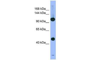 PSMD1 antibody used at 1 ug/ml to detect target protein. (PSMD1 抗体)
