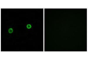 Immunofluorescence (IF) image for anti-Acyl-CoA Thioesterase 4 (ACOT4) (C-Term) antibody (ABIN1850684) (ACOT4 抗体  (C-Term))