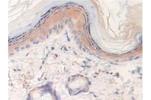 Detection of LXN in Rat Skin Tissue using Polyclonal Antibody to Latexin (LXN) (Latexin 抗体  (AA 1-223))
