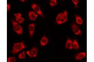 Immunofluorescence (fixed cells) (IF/ICC) image for anti-Olfactory Receptor, Family 4, Subfamily K, Member 2 (OR4K2) (C-Term) antibody (ABIN6263867)