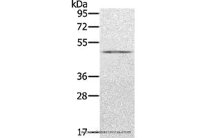 Western blot analysis of Human normal stomach tissue, using KDM8 Polyclonal Antibody at dilution of 1:500 (JMJD5 抗体)