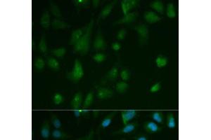 Immunofluorescence analysis of HeLa cells using ARRB1 Polyclonal Antibody (beta Arrestin 1 抗体)