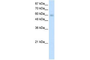 WB Suggested Anti-GATAD2B Antibody Titration:  0.