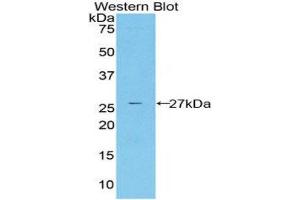 Western Blotting (WB) image for anti-Cysteine-Rich, Angiogenic Inducer, 61 (CYR61) (AA 178-381) antibody (ABIN1858600) (CYR61 抗体  (AA 178-381))
