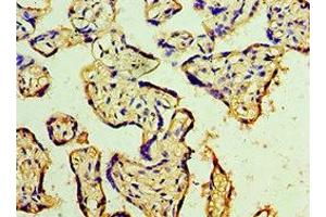 Immunohistochemistry of paraffin-embedded human placenta tissue using ABIN7150706 at dilution of 1:100 (MAP2K3 抗体  (AA 1-170))