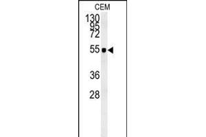 ZIC3 Antibody (Center) (ABIN650719 and ABIN2839389) western blot analysis in CEM cell line lysates (35 μg/lane). (ZIC3 抗体  (AA 239-267))