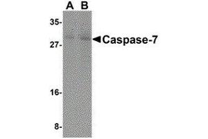 Western Blotting (WB) image for anti-Caspase 7, Apoptosis-Related Cysteine Peptidase (CASP7) (N-Term) antibody (ABIN2477919) (Caspase 7 抗体  (N-Term))