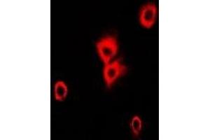 Immunofluorescent analysis of Alpha-tubulin 4a staining in Hela cells. (TUBA4A 抗体)
