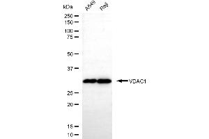 Western blotting analysis using VDAC1 antibody (ABIN7800845).