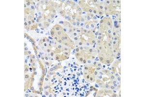 Immunohistochemistry of paraffin-embedded mouse kidney using BSND antibody. (BSND 抗体  (AA 54-320))