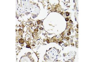 Immunohistochemistry (IHC) image for anti-Interleukin 6 Receptor (IL6R) (AA 20-320) antibody (ABIN3015522)