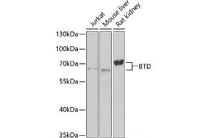 Western blot analysis of extracts of various cell lines using BTD Polyclonal Antibody at dilution of 1:1000. (BTD 抗体)